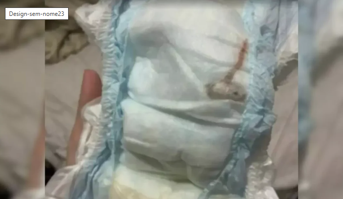Perícia indica que material encontrado em fralda de bebê não é rato